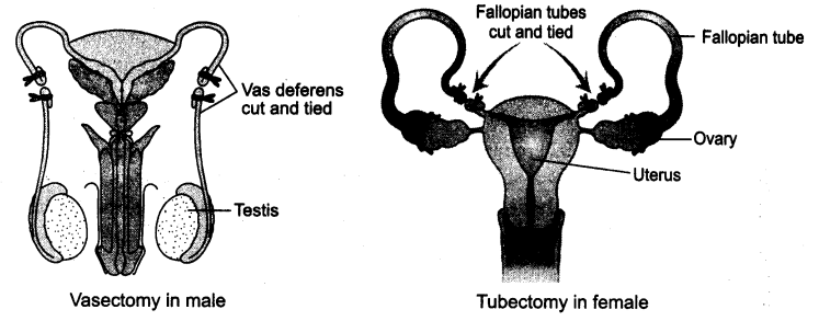 reproductive-health-cbse-notes-class-12-biology-1